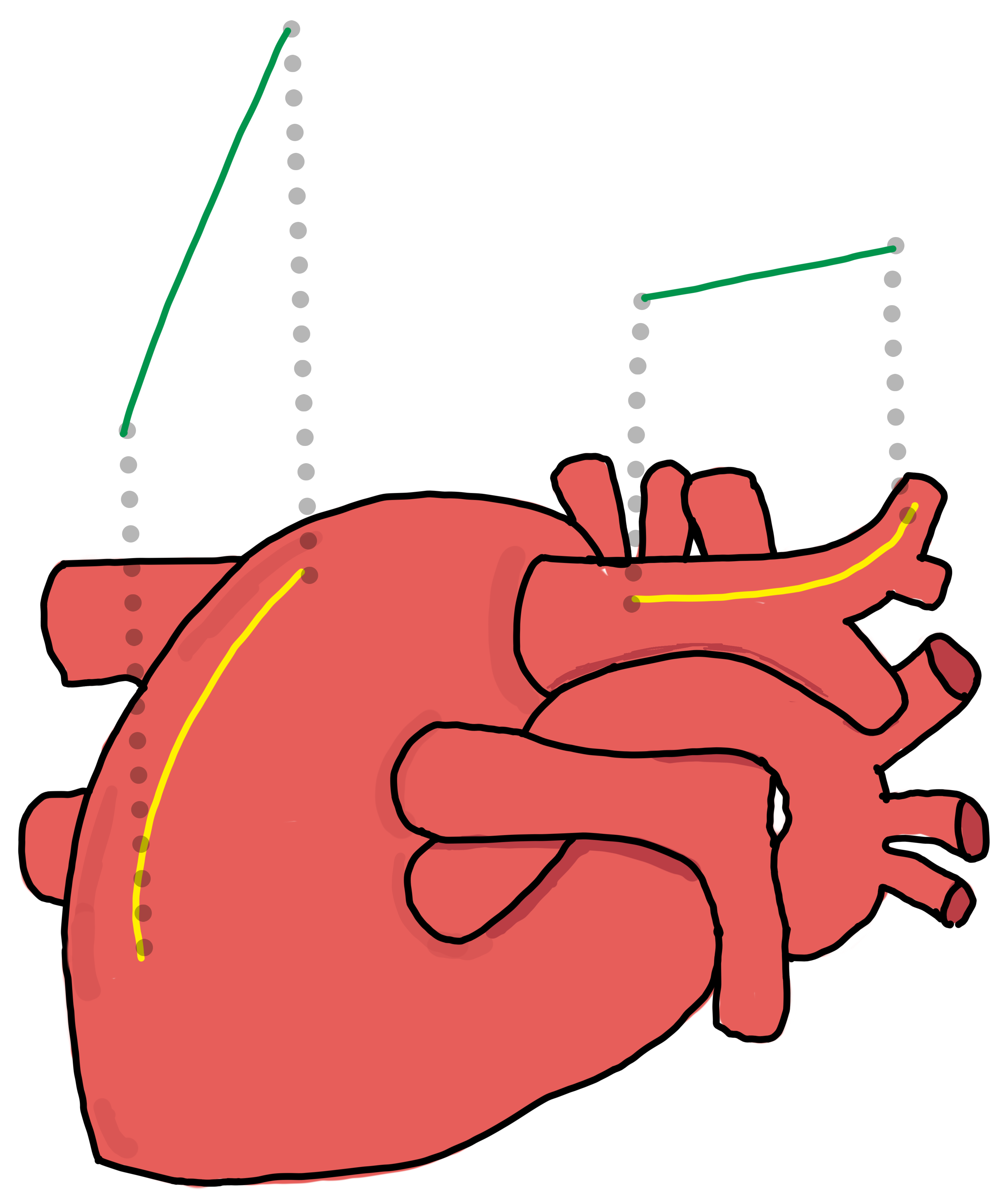 A drawn heart that shows how the trace of the user is reflected using path guidance.